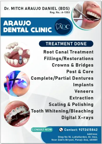 Teeth Whitening in Goa